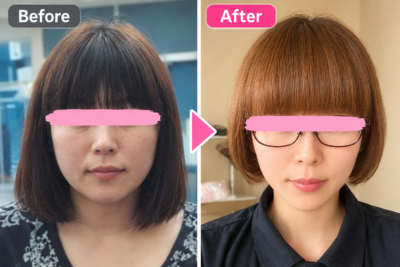 顔痩せとフェイスライン引き締めのビフォーアフター写真